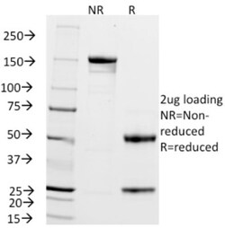 ZAP70 Antibody (2F3.2), Novus Biologicals 0.2mg; Unlabeled:Antibodies,